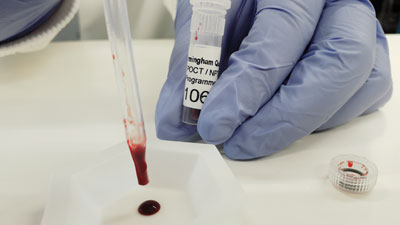 Photo of pastette from artificially glycated whole blood